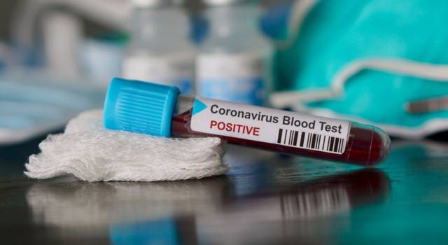 Cibo e coronavirus:  il decalogo anti-bufale